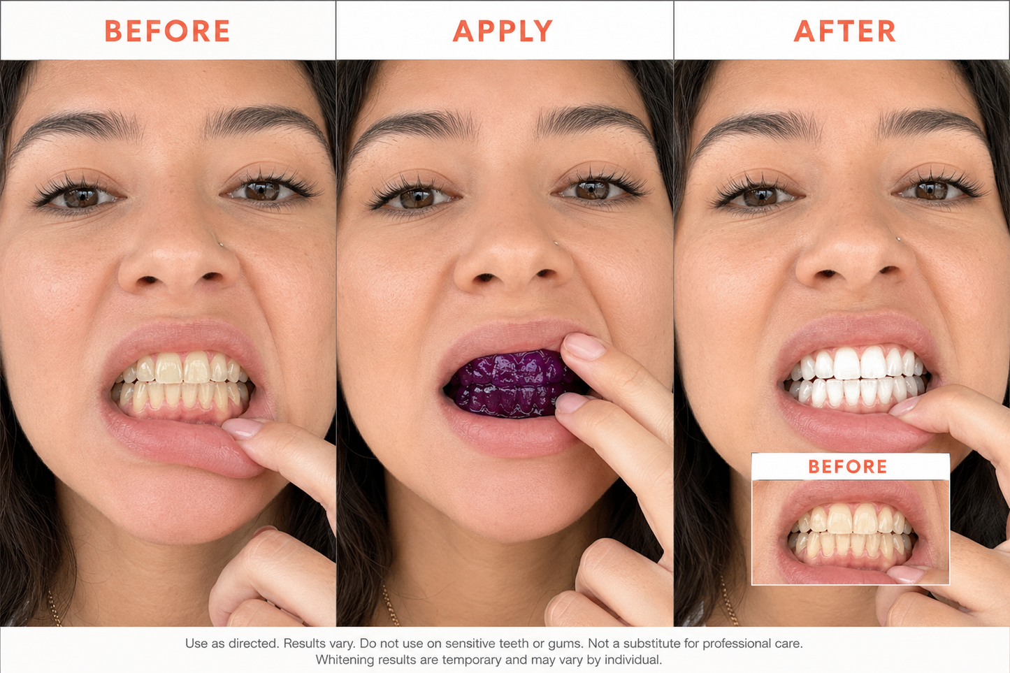 Purple Whitening Strips: Visibly Whiter in One Use